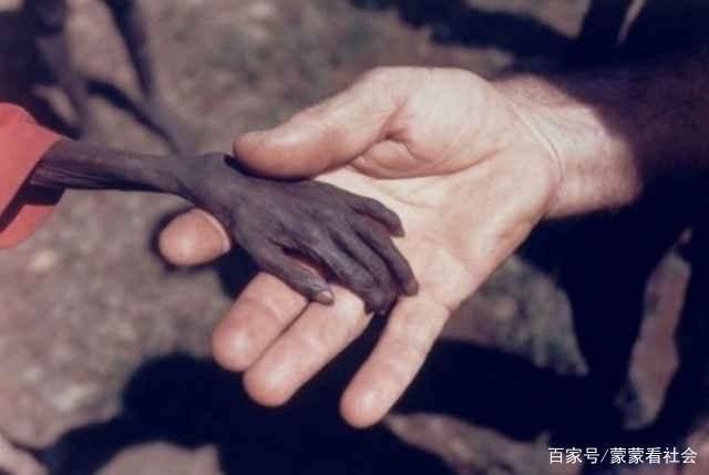 非洲饥饿儿童手臂