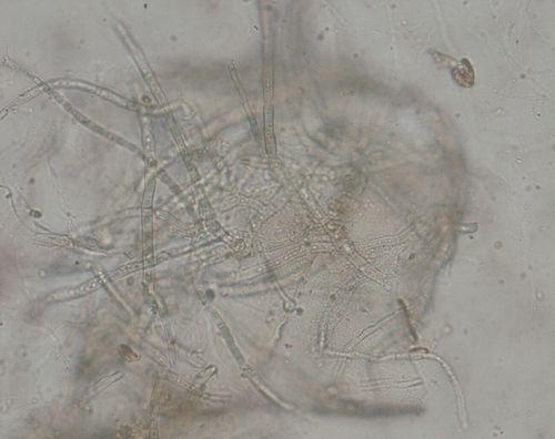 关于显微镜中霉菌的观察