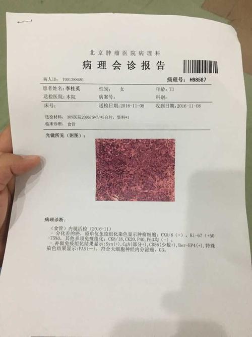 谁能帮忙看看这份病理报告大细胞神经内分泌癌可怕吗