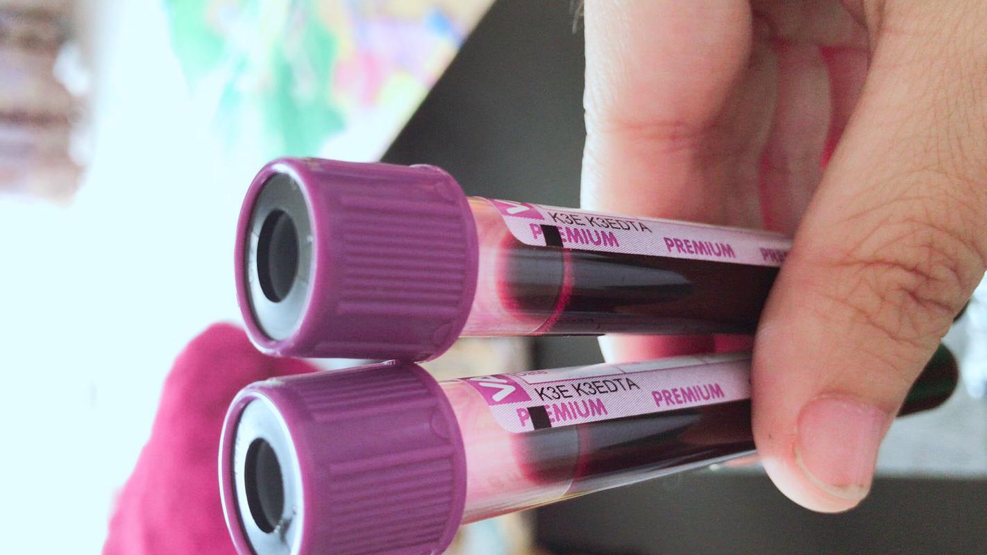 香港验血邮寄血液不会坏吗邮寄验血攻略分享