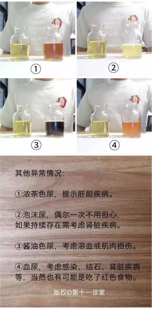 尿液颜色和健康的关系,你知道多少?