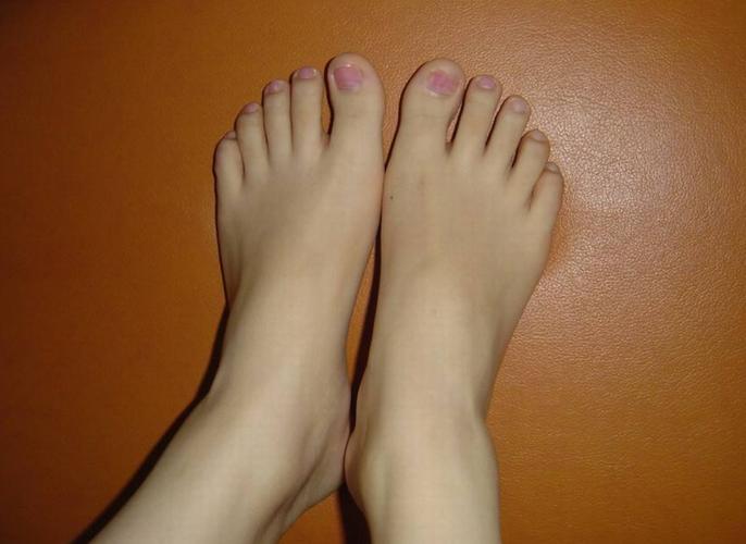 女人脚上的这4个表现,是癌症的信号,别忽视