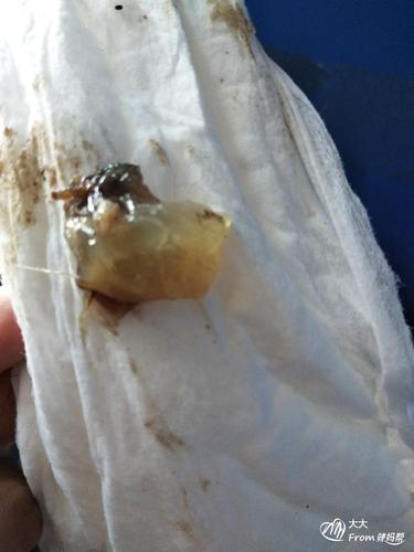 这是宫颈粘液拴吗,今天预产期流出来一坨