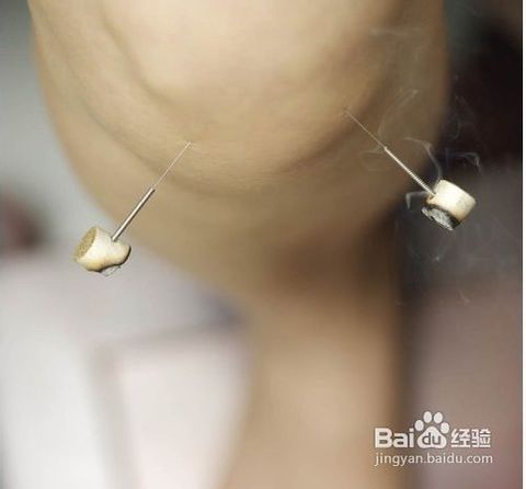 3,适应证:湿热型前列腺增生.