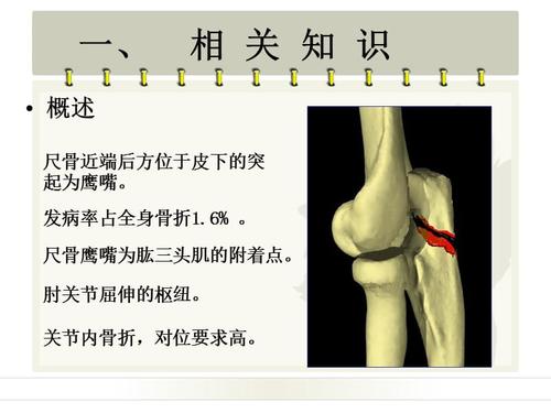 尺骨鹰嘴骨折ppt医学课件