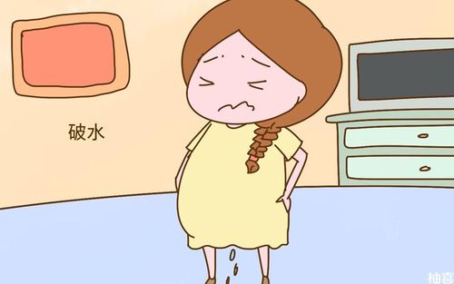 破水,宫缩是臀位孕妇分娩症状