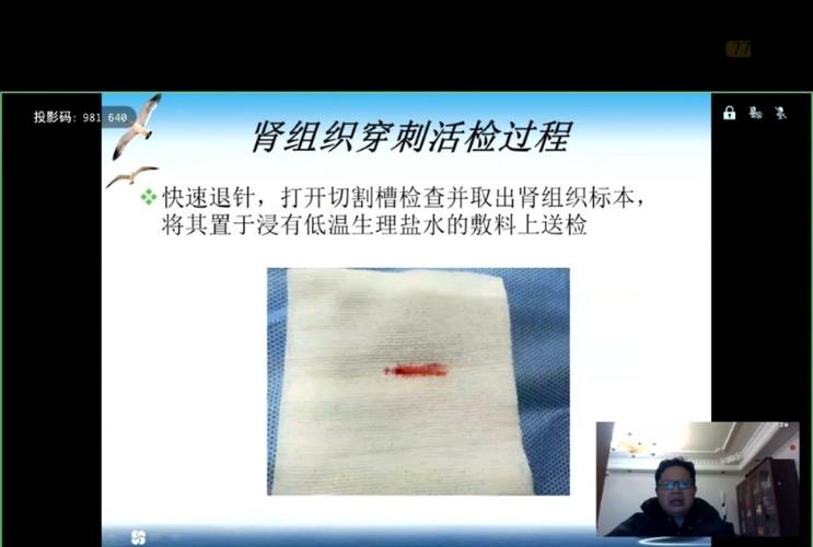 肾穿刺