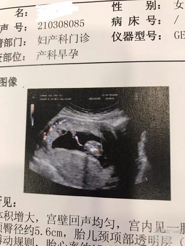 为什么我nt图片跟别人不一样 宝妈们 能