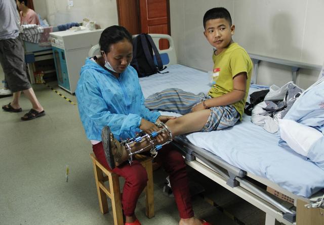 脑瘫智障脑瘫只是运动和姿势有异常并不都会影响到智力