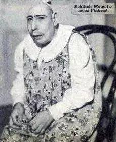 小头症患者schlitzie(马戏团演员)