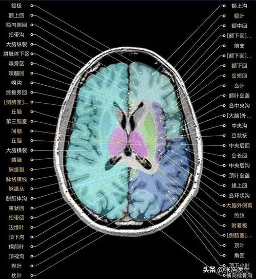 颅脑mri高清解剖图谱附带详细标注