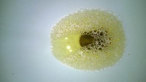 蛋白尿的泡沫是什么样子的有图吗