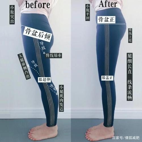 骨盆后倾,大腿前侧突出自我检测!教你四个动作矫正骨盆歪斜