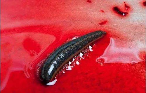 洪涝灾害时要小心水中的"吸血虫"_水蛭