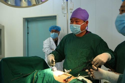 永城市第二人民医院外科腹腔镜阑尾切除术