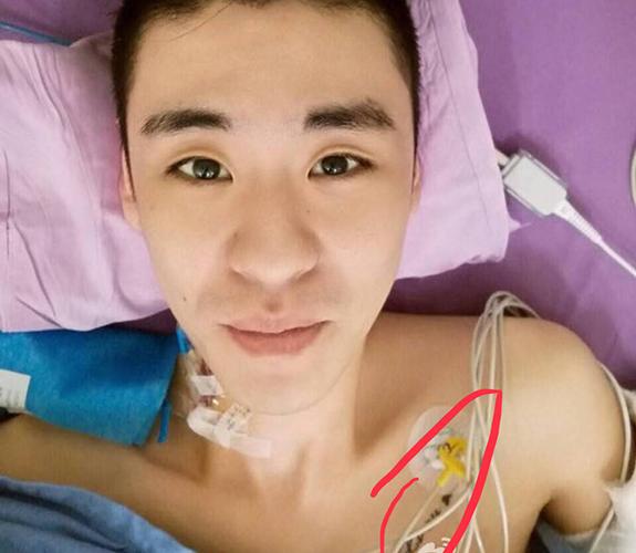 张云雷胸口纹身liou张云雷是gay喜欢李欧是真的吗