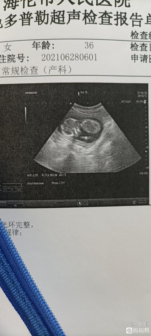 求知男宝,女宝b超图片