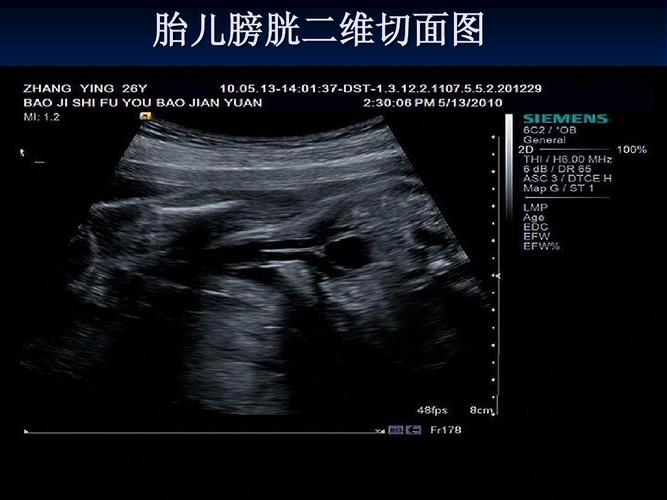 你可能喜欢 心脏超声检查 胎儿畸形超声诊断 心脏解剖 心脏超声课件