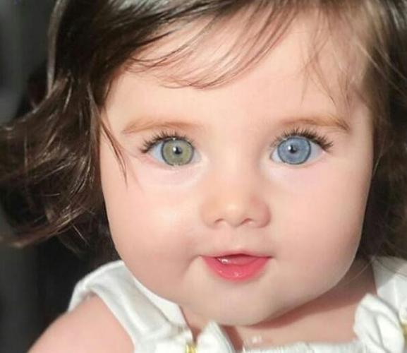 上天赐的礼物!可爱小女孩眼睛一只蓝一只绿