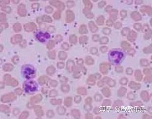 中性粒细胞和巨噬细胞吞噬功能检测