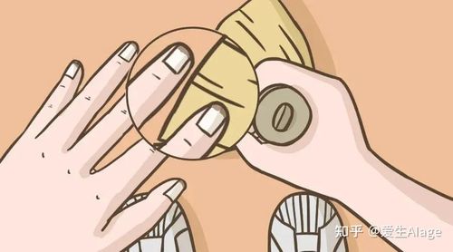 月牙消失有竖纹几个关于指甲健康的小秘密