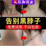 脖子黑脖子黑色素颈部沉淀全身关节身体黑棘皮洗不干净非去黑非去除