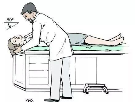 图文并茂:手把手教你诊治良性阵发性位置性眩晕(耳石症)丨临床必备