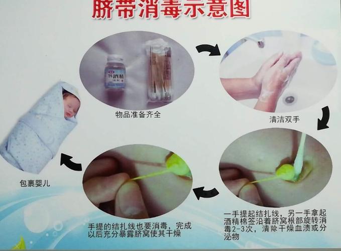 正确消毒脐带方法