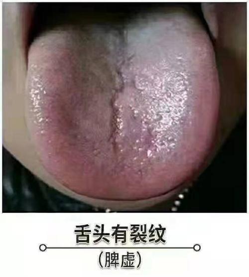 舌头里的语言