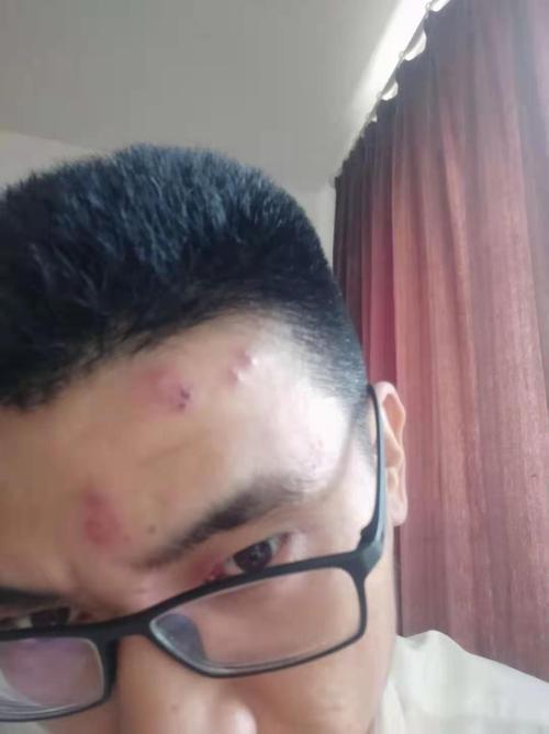 头上长有红点很痛刺痛医院可以看吧