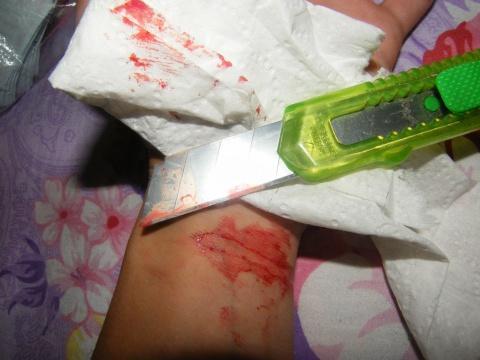 自残割手腕真实图片