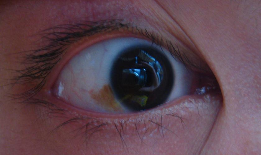 眼白上有一小块黄斑