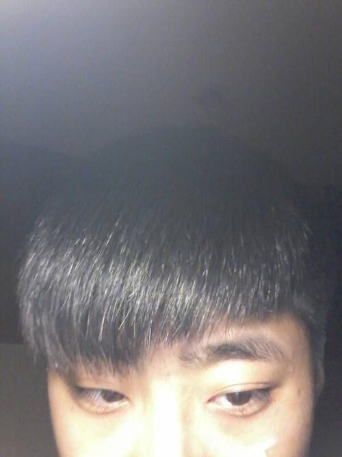 我是男生 想要留刘海 头发比较硬 右边有个旋导致头发向上长 做过软化