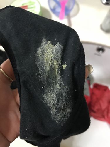 前两天的白带还是透明拉丝的,然后一到排卵期的那两天就这样,有的豆腐