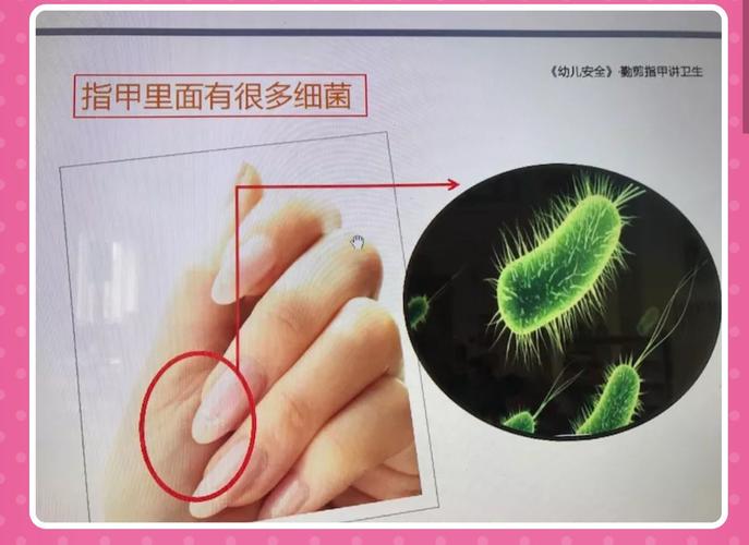 指甲里面还会藏着许多细菌