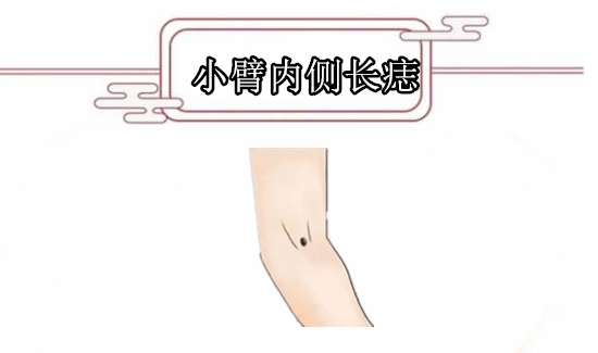 小臂内侧长痣