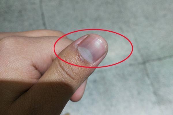 指甲上有月牙的人和没有月牙的人,有啥区别?哪类人更健康?