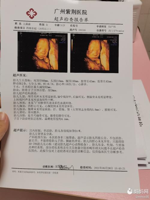 四维过了,小家伙长的好像爸爸,问了下性别如愿了,就是肾盂分离5.