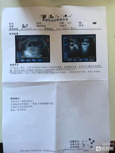 彩超早孕,其他都正常,但是右卵巢有无回声块,不知道会