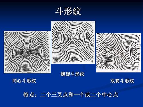 实验一 人类某些遗传性状 和皮肤纹理的观察 斗形纹 螺旋斗形纹 同心