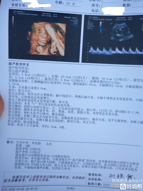 四维彩超通过,已知男女宝宝,姐妹们猜猜是
