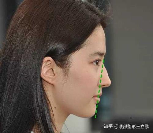 侧脸丑而正脸好看是一种什么体验?