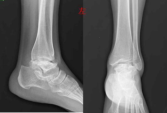 zt0203:共同学习大骨节病