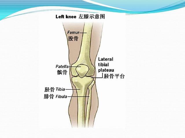 胫骨髁骨折,患者临床表现有膝关节疼痛等,石膏固定可以防止畸形