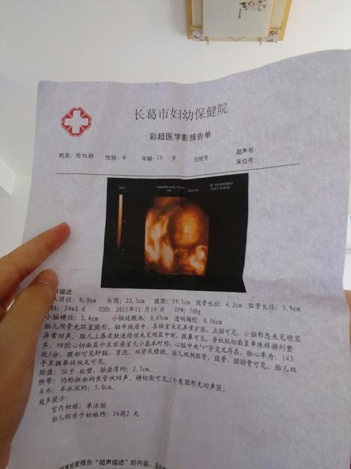 24周四维照只看楼主