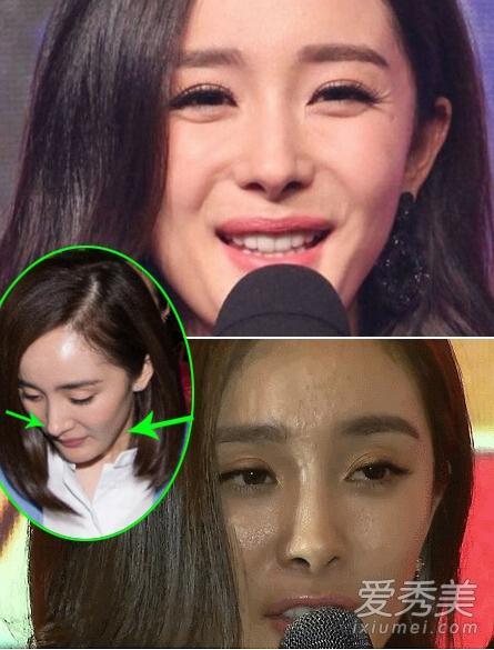 女星素颜近照起底:柳岩baby杨幂气色差 颜值低