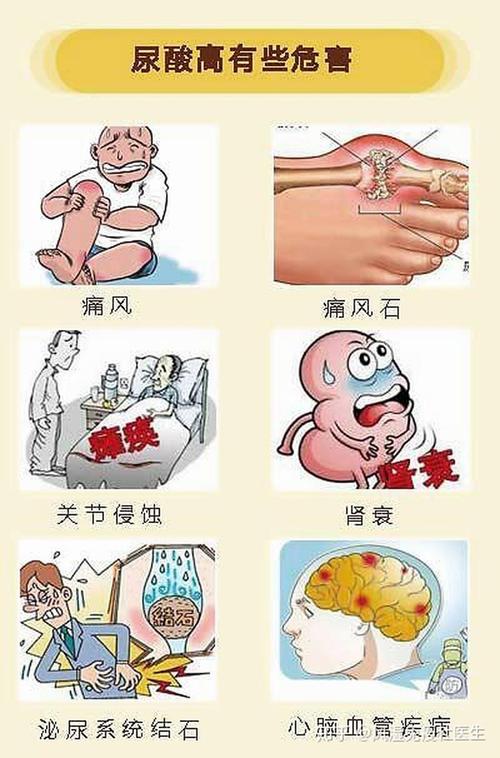 痛风:降尿酸药物要怎么吃?