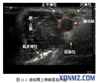 超声引导区域阻滞专家共识_new_new要点解析.docx 46页