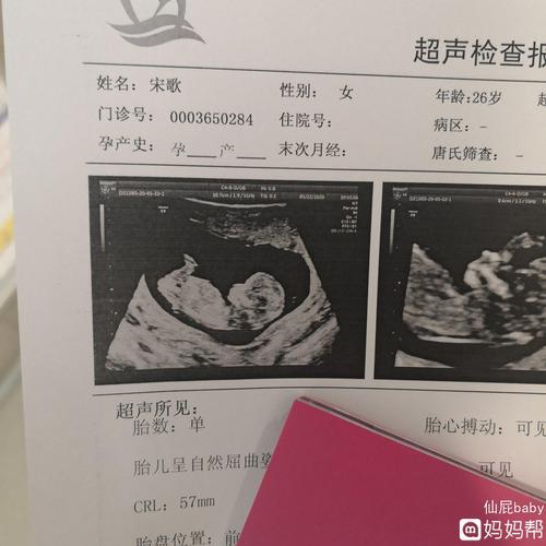 nt秒过,宝宝的照片太清楚了,好可爱[亲