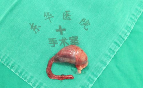 主诉 病史 主诉:发列右侧睾丸肿大4天  现病史:4天前家属发现患儿